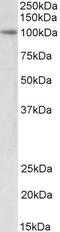 Ubiquitin Like With PHD And Ring Finger Domains 1 antibody, LS-C186521, Lifespan Biosciences, Western Blot image 