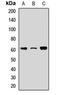 Retinoid Isomerohydrolase RPE65 antibody, LS-C668230, Lifespan Biosciences, Western Blot image 