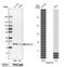 Family With Sequence Similarity 210 Member A antibody, NBP2-13991, Novus Biologicals, Western Blot image 