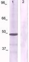 Jun Proto-Oncogene, AP-1 Transcription Factor Subunit antibody, TA354680, Origene, Western Blot image 