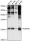 Pleckstrin Homology Domain Containing B2 antibody, A12755, Boster Biological Technology, Western Blot image 