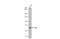 Cystathionine-Beta-Synthase antibody, NBP1-33518, Novus Biologicals, Western Blot image 