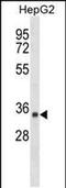 Short Chain Dehydrogenase/Reductase Family 39U Member 1 antibody, PA5-48991, Invitrogen Antibodies, Western Blot image 