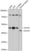 Acyl-CoA Thioesterase 2 antibody, 15-517, ProSci, Western Blot image 