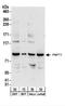 Polyribonucleotide Nucleotidyltransferase 1 antibody, NBP2-22269, Novus Biologicals, Western Blot image 