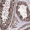 Zinc Finger Protein 662 antibody, HPA039116, Atlas Antibodies, Immunohistochemistry paraffin image 