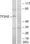 General Transcription Factor IIH Subunit 2 antibody, A30489, Boster Biological Technology, Western Blot image 