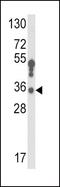 Hydroxysteroid 17-Beta Dehydrogenase 3 antibody, PA5-26524, Invitrogen Antibodies, Western Blot image 