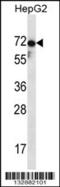 Zona Pellucida Glycoprotein 1 antibody, 56-916, ProSci, Western Blot image 