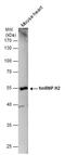 Heterogeneous Nuclear Ribonucleoprotein H2 antibody, GTX106825, GeneTex, Western Blot image 