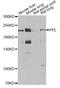 Periplakin antibody, A6950, ABclonal Technology, Western Blot image 