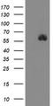 Serine Peptidase Inhibitor, Kunitz Type 1 antibody, CF504664, Origene, Western Blot image 