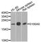 S100 Calcium Binding Protein A9 antibody, STJ111884, St John