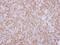 Profilin 1 antibody, GTX102072, GeneTex, Immunohistochemistry paraffin image 