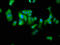 Dysbindin-1 antibody, LS-C672342, Lifespan Biosciences, Immunofluorescence image 