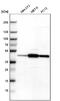 Tropomodulin 3 antibody, NBP1-86870, Novus Biologicals, Western Blot image 