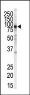 Inhibitor Of Nuclear Factor Kappa B Kinase Subunit Beta antibody, MA5-11177, Invitrogen Antibodies, Western Blot image 