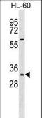 Homeobox B13 antibody, LS-C164405, Lifespan Biosciences, Western Blot image 