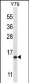 Nuclear Receptor 2C2 Associated Protein antibody, PA5-48416, Invitrogen Antibodies, Western Blot image 