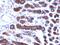 Mesothelin antibody, GTX17953, GeneTex, Immunohistochemistry paraffin image 