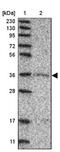 Glycogenin 1 antibody, NBP1-89723, Novus Biologicals, Western Blot image 