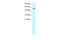 RUNX1 Partner Transcriptional Co-Repressor 1 antibody, 27-986, ProSci, Enzyme Linked Immunosorbent Assay image 