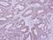 Protein Kinase CAMP-Dependent Type II Regulatory Subunit Beta antibody, GTX105558, GeneTex, Immunohistochemistry paraffin image 