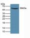 Matrix Metallopeptidase 14 antibody, LS-C314878, Lifespan Biosciences, Western Blot image 