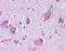 Histamine Receptor H1 antibody, NLS1167, Novus Biologicals, Immunohistochemistry paraffin image 