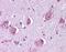Histamine H1 receptor antibody, NLS1167, Novus Biologicals, Immunohistochemistry paraffin image 