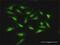 Stomatin antibody, H00002040-D01P, Novus Biologicals, Immunocytochemistry image 