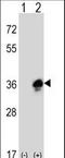 Myelin Protein Zero antibody, LS-C164617, Lifespan Biosciences, Western Blot image 