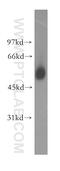 tRNA-splicing endonuclease subunit Sen2 antibody, 13103-2-AP, Proteintech Group, Western Blot image 