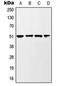 Glycogen Synthase Kinase 3 Alpha antibody, MBS820195, MyBioSource, Western Blot image 