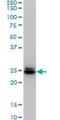 High Mobility Group Box 2 antibody, H00003148-M02, Novus Biologicals, Western Blot image 