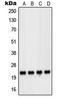 Parkinsonism Associated Deglycase antibody, LS-C353341, Lifespan Biosciences, Western Blot image 