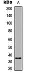 Caspase 6 antibody, orb304708, Biorbyt, Western Blot image 