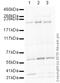 SWI/SNF Related, Matrix Associated, Actin Dependent Regulator Of Chromatin, Subfamily A, Member 2 antibody, ab15597, Abcam, Western Blot image 