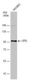 Adhesion G Protein-Coupled Receptor L4 antibody, GTX130314, GeneTex, Western Blot image 