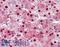 Poly(ADP-Ribose) Polymerase 1 antibody, LS-B3395, Lifespan Biosciences, Immunohistochemistry paraffin image 