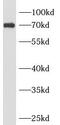 Ankyrin Repeat Domain 13B antibody, FNab00407, FineTest, Western Blot image 