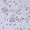 Transcription factor SOX-5 antibody, A6985, ABclonal Technology, Immunohistochemistry paraffin image 