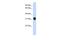 Dynein Axonemal Light Intermediate Chain 1 antibody, PA5-44079, Invitrogen Antibodies, Western Blot image 