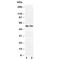 Aldehyde Dehydrogenase 1 Family Member A1 antibody, R30756, NSJ Bioreagents, Western Blot image 