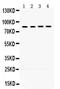 Cytochrome P450 Oxidoreductase antibody, PB9736, Boster Biological Technology, Western Blot image 