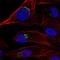 Tyrosylprotein Sulfotransferase 1 antibody, HPA061837, Atlas Antibodies, Immunofluorescence image 