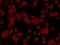 Janus Kinase 2 antibody, NBP2-66913, Novus Biologicals, Immunofluorescence image 