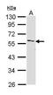 Interleukin 1 Receptor Associated Kinase 4 antibody, GTX113323, GeneTex, Western Blot image 