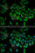 NADH-ubiquinone oxidoreductase 75 kDa subunit, mitochondrial antibody, A2592, ABclonal Technology, Immunofluorescence image 