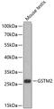 Glutathione S-transferase Mu 2 antibody, 15-023, ProSci, Western Blot image 